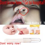 Baby Nose Cleaner Nasal Tweezer - Image 2