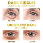 Best Gold Under Eye Mask for Eye Care - Image 7